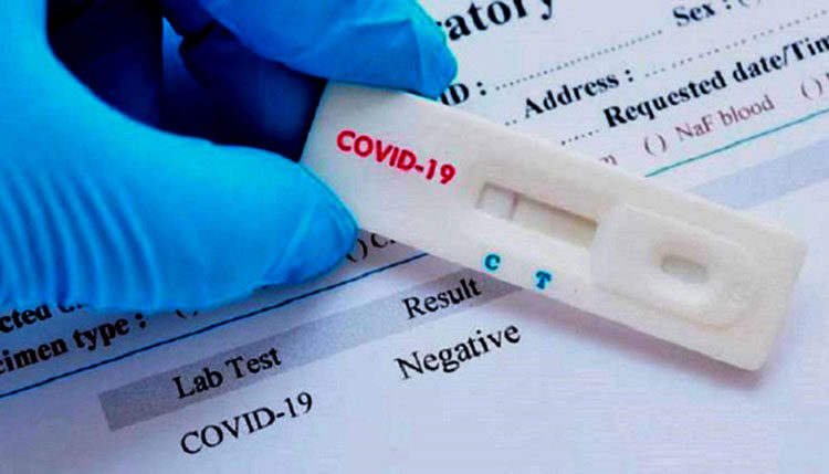 Τεστ αντιγόνου για την ανίχνευση του κορονοϊού (Rapid covid-19 antigen test)